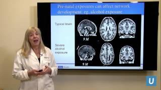 How Does a Child's Brain Develop? | Susan Y. Bookheimer PhD | UCLAMDChat