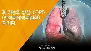 폐 기능의 상실, COPD(만성폐쇄성폐질환) 폐기종 - (2018.6.20_651회 방송) 기침과 호흡 곤란을 잡아라, 숨통이 트인다