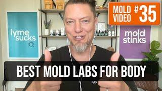 Which labs should I start with for mold?