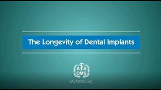 The Longevity of Dental Implants