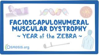 Facioscapulohumeral muscular dystrophy (Year of the Zebra)