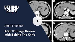ABSITE Image Review with Behind The Knife