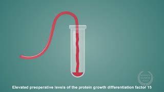 Association of Preoperative Growth Differentiation Factor-15 Concentrations and Postoperative...