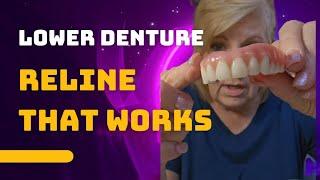 How To Get Your LOWER DENTURE To Fit Better