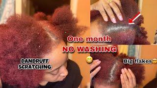 DANDRUFF SCRAPING Removal  | One month NO WASHING  | Hair Journey ‍️