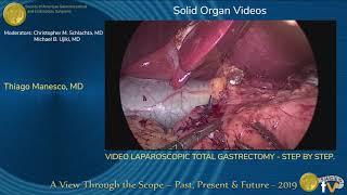 VIDEO LAPAROSCOPIC TOTAL GASTRECTOMY - STEP BY STEP