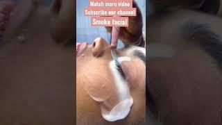 #subscribetomychannel #chennai #cupping #hijama #trending #face #facial #bridalmakeup #shorts #bts