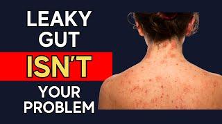 How To Get Rid Of Eczema And Chronic Skin Problems When Functional Medicine Fails