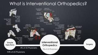 What is Interventional Orthopedics?