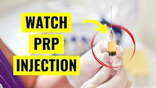 Watch a PRP Injection for Knee Arthritis Pain! (Ultrasound Guidance)