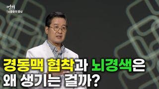 경동맥 협착과 뇌경색, 바로 '이것' 때문에 생긴다! | 경동맥 협착 | 뇌경색 | 명의 | #EBS건강