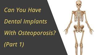 Can You Have Dental Implants With Osteoporosis?