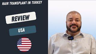 Hair Transplant in Turkey l Patient's Review l Worbimed Clinic