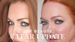 Before + After | Six Years of Using ZIIP Beauty Halo + Exclusive Discount Code