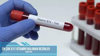 B12 vitamini hangi besinlerde bulunur B12 vitamini eksikliği belirtileri - Doktorum TV