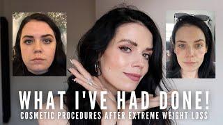 What I've Had Done - Cosmetic Procedures After Extreme Weight Loss | Half of Carla