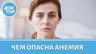 Анемия: симптомы, диагностика, лечение