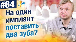 Можно ли на 1 имплант поставить 2 зуба?