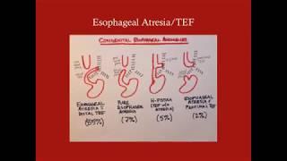 Surgical Problems of the Neonate - CRASH! Medical Review Series