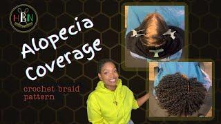 Best Crochet Braid Pattern for Alopecia