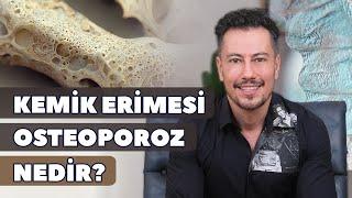 Kemik Erimesi - Osteoporoz Nedir?