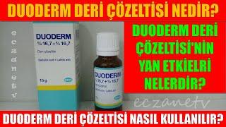 Duoderm Deri Çözeltisi Nedir? Duoderm Deri Çözeltisi'nin Yan Etkisi Nedir? Duoderm Nasıl Kullanılır?