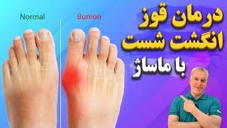 چگونه با 4 حرکت و ماساژ موثر خانگی قوز شست پا را درمان کنیم؟