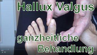 Ursächliche Therapie des Hallux Valgus