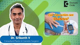 Reversing Diabetes With Liposuction #plasticsurgery #diabetes  - Dr. Srikanth V | Doctors' Circle