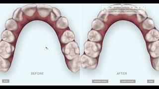 treatment plan simulation F. R. G.