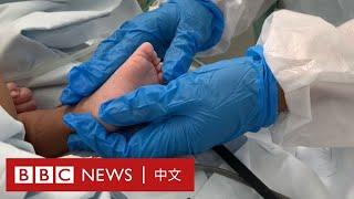 新冠疫情：為什麼巴西很多嬰兒死於新冠病毒？－ BBC News 中文