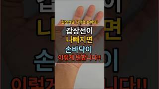 갑상선이 망가지면 손바닥이 이렇게 변합니다! #건강정보 #건강한중년 #장수의비밀 #중년건강 #50대건강 #건강상식 #건강 #지식 #건강관리
