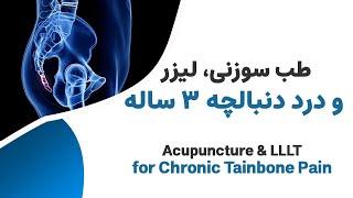 درد دنبالچه سه ساله و طب سوزنی- Laser Acupuncture for tailbone pain