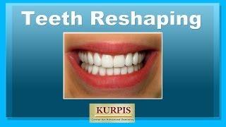 Teeth Reshaping