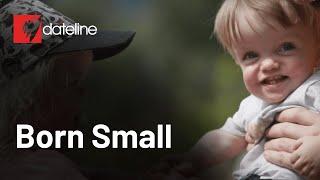 Dwarfism and the drug that could change everything | Full episode | SBS Dateline