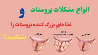 غذاهای بزرگ کننده پروستات را بشناس و با خیال راحت غذاهایِ بی ضرر را انتخاب کن!!