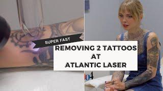 REMOVING TWO TATTOOS at Atlantic Laser Tattoo Removal in Virginia Beach