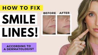 How to Fix Wrinkles Around the Mouth | Smile Lines and Sagging Skin | Dr. Sam Ellis