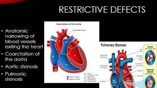 Pediatric Cardiovascular Disorders