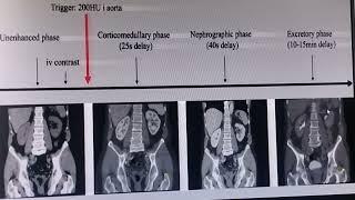 CT SCAN INTERVIEW WITH NCCT KUB CECT KUB UROGRAPHY