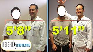 Man Gains 3 Inches in Height After Height Lengthening Procedure | #Shorts