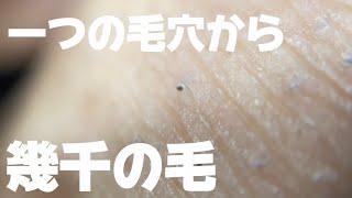 【毛抜き】一つの毛穴から出過ぎじゃない？