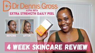 Clear Hyperpigmentation & Even Skin Tone? | Dr. Dennis Gross Alpha Beta Pads Review