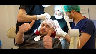 Fue Hair Transplant Procedure Step by Step | Dr. Bayer Clinics: Hair Transplant Clinic in Turkey 