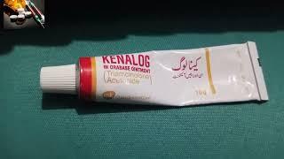 kenalog  cream (oral ulcer treatment)