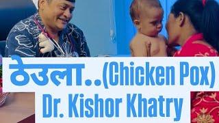 ठेउला..(Chicken Pox)Dr. Kishor Khatry #swasthyapharmacy #chickenpox #babyhealthcare