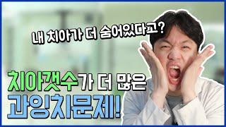 정상 치아 개수보다 더 많은 과잉치? 어떻게 할까?