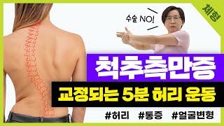 수술 NO!!! 기적의 25도 척추측만증 홈트운동