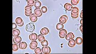Микроскопия нативной крови, лейкоцит, эритроциты