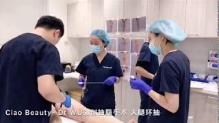 Sydney Ciao Beauty - Liposuction (Thighs) By Dr WU